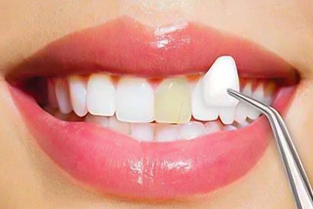 CosmeticDentistry11