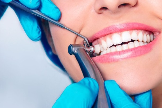 tooth cleaning and scalling (1) (1)
